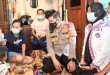 Photo of Polresta Tangerang Biayai Perawatan Bocah Korban Penganiayaan